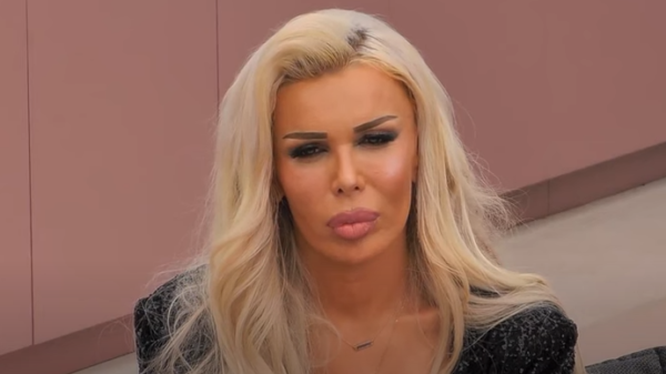 Edona James bën ndryshimin e radhës, ndryshon ngjyrën e lëkurës